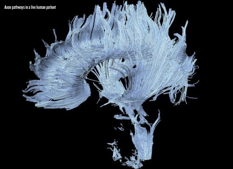 the beauty brain the beauty brain