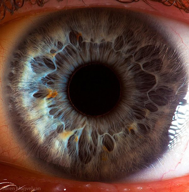 eye 3