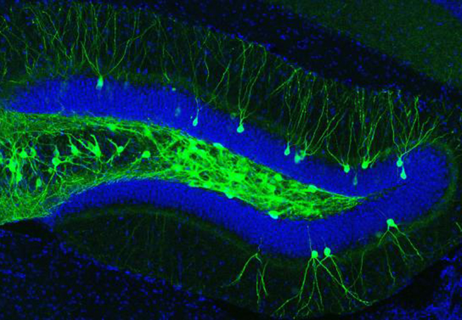 The WOW Files: Two Breakthrough Alzheimer’s Treatments Restore Nearly 100% Full Memory Function