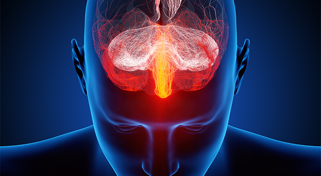 New Drug Treatment For Migraines Is Like A Miracle